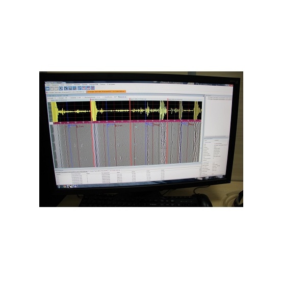 Установка для механизированного ультразвукового контроля MSCAN-SUPOR