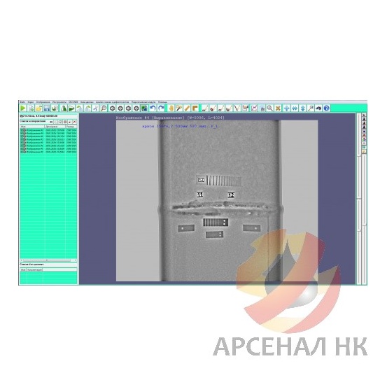 Стационарные комплексы цифровой радиографии Экоскан